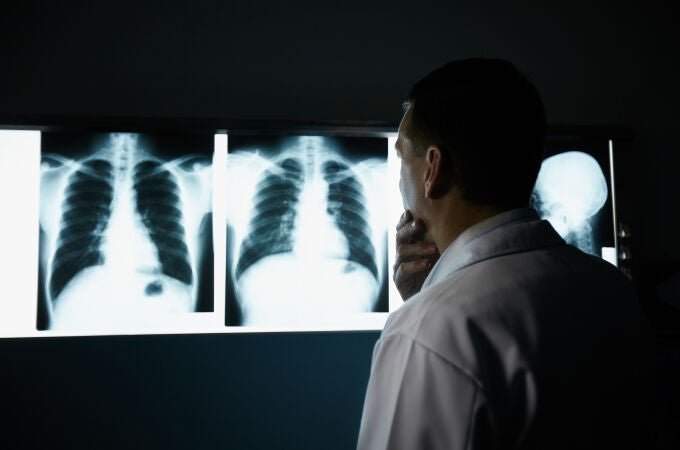 Los expertos hablan de avances muy importantes en la supervivencia de los pacientes