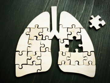 C&aacute;ncer de pulm&oacute;n