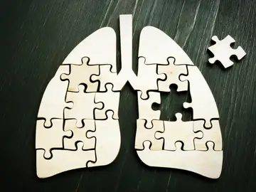 Cáncer de pulmón Cáncer de pulmón