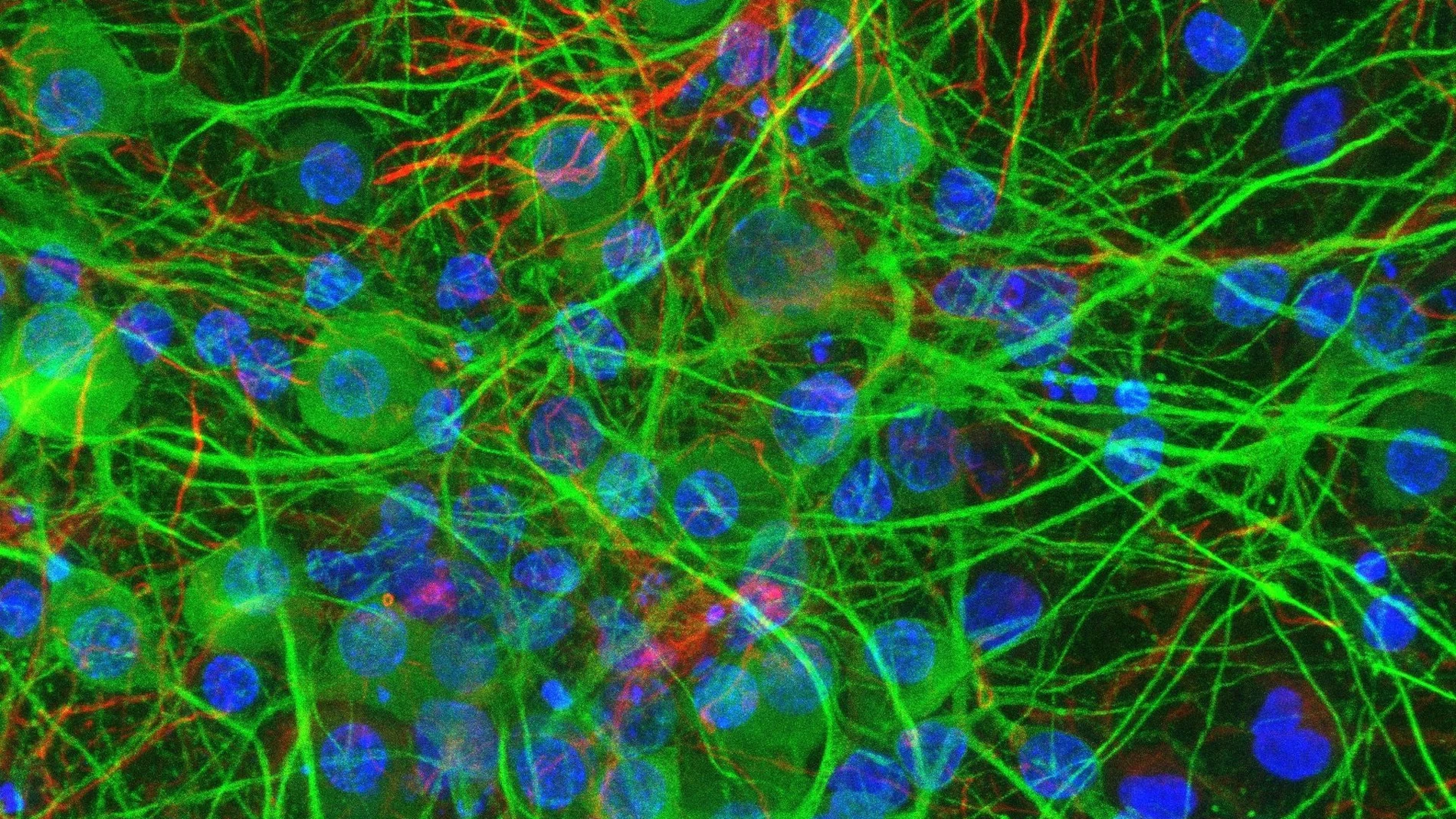 Descubren que ciertas bacterias intestinales modifican directamente la actividad de las neuronas al tocarlas