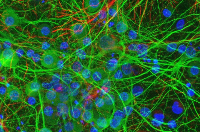 Cultivo 2D de células neuronales corticales (de cerebro): neuronas (verde) y células de glía (rojo). 