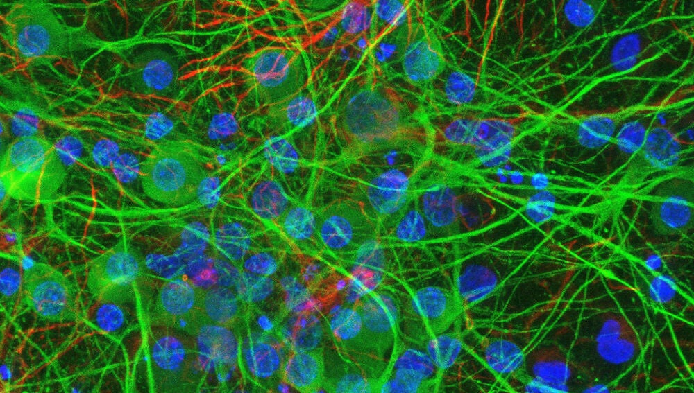 Cultivo 2D de c&eacute;lulas neuronales corticales (de cerebro): neuronas (verde) y c&eacute;lulas de gl&iacute;a (rojo). 