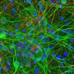 Cultivo 2D de células neuronales corticales (de cerebro): neuronas (verde) y células de glía (rojo). 