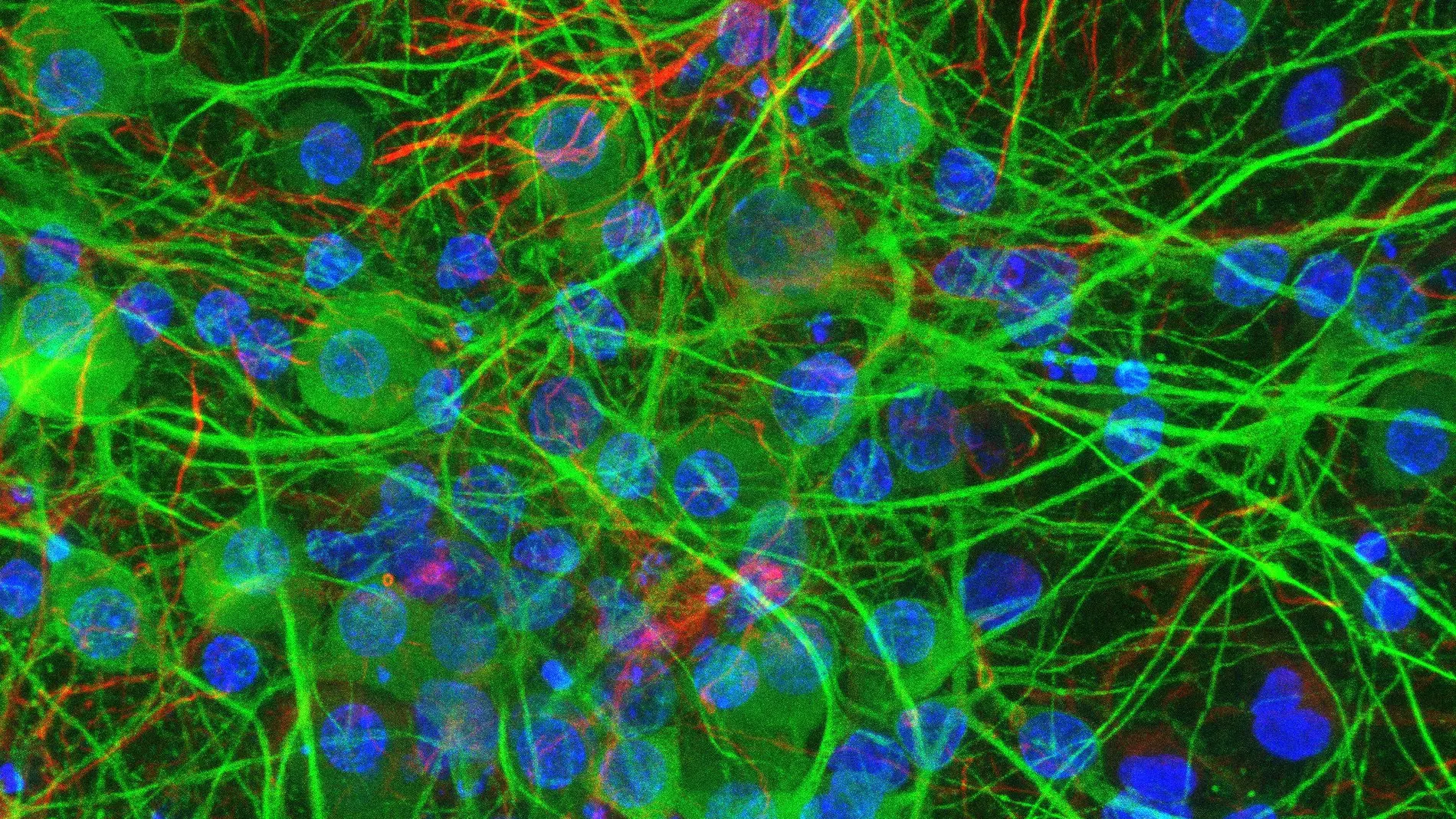 Cultivo 2D de células neuronales corticales (de cerebro): neuronas (verde) y células de glía (rojo).