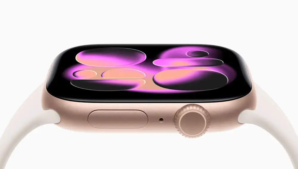Apple Watch Series 11.