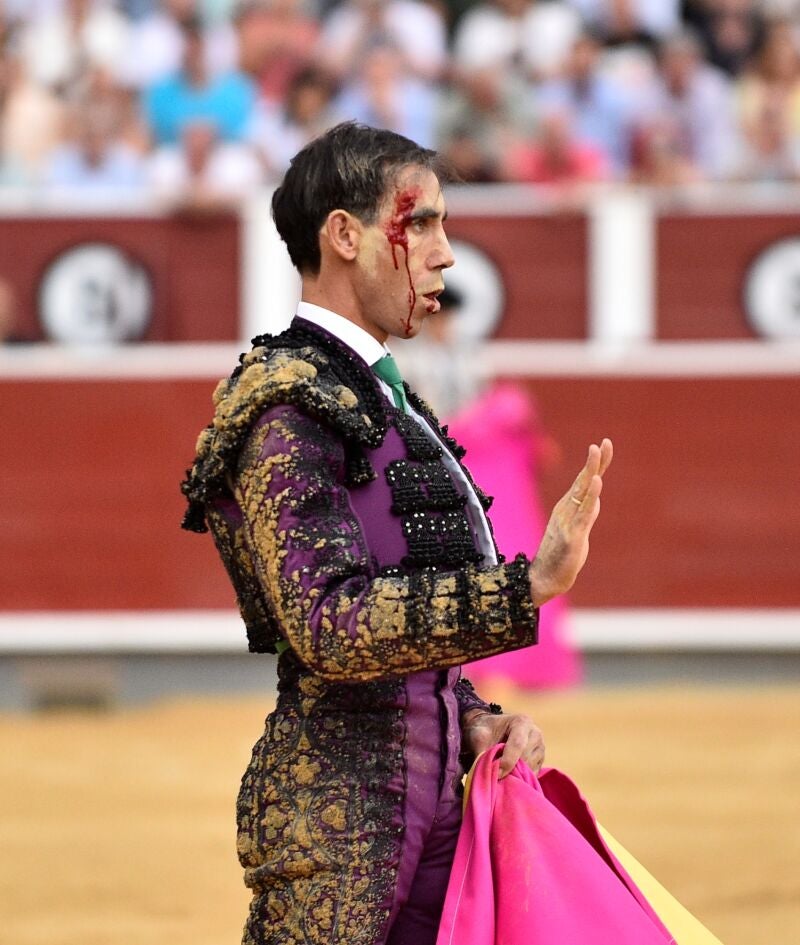 Fortes tras el percance
