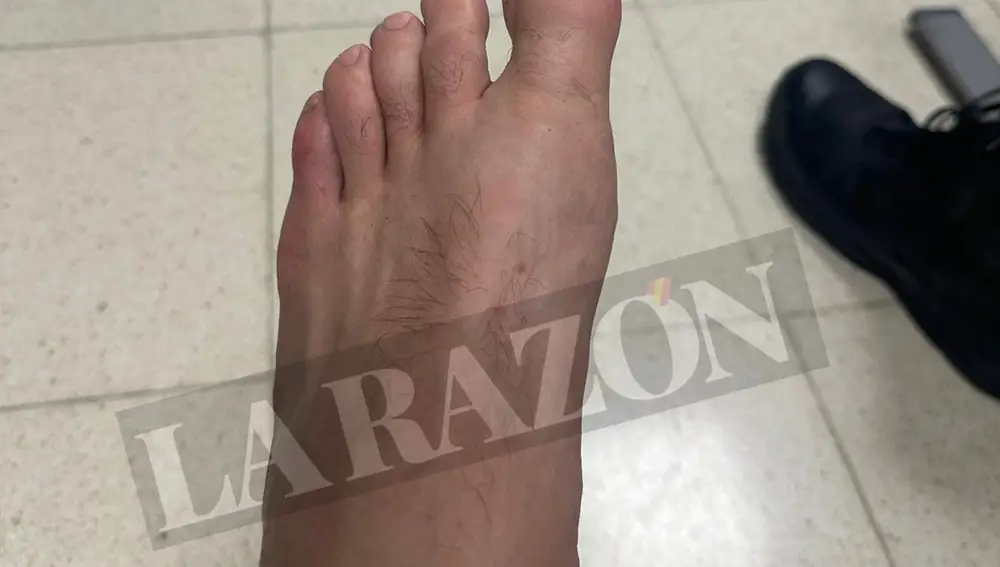 Las heridas de los antidisturbios en los incidentes de la Vuelta en Madrid