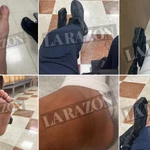 Las heridas de los antidisturbios en los incidentes de la Vuelta en Madrid
