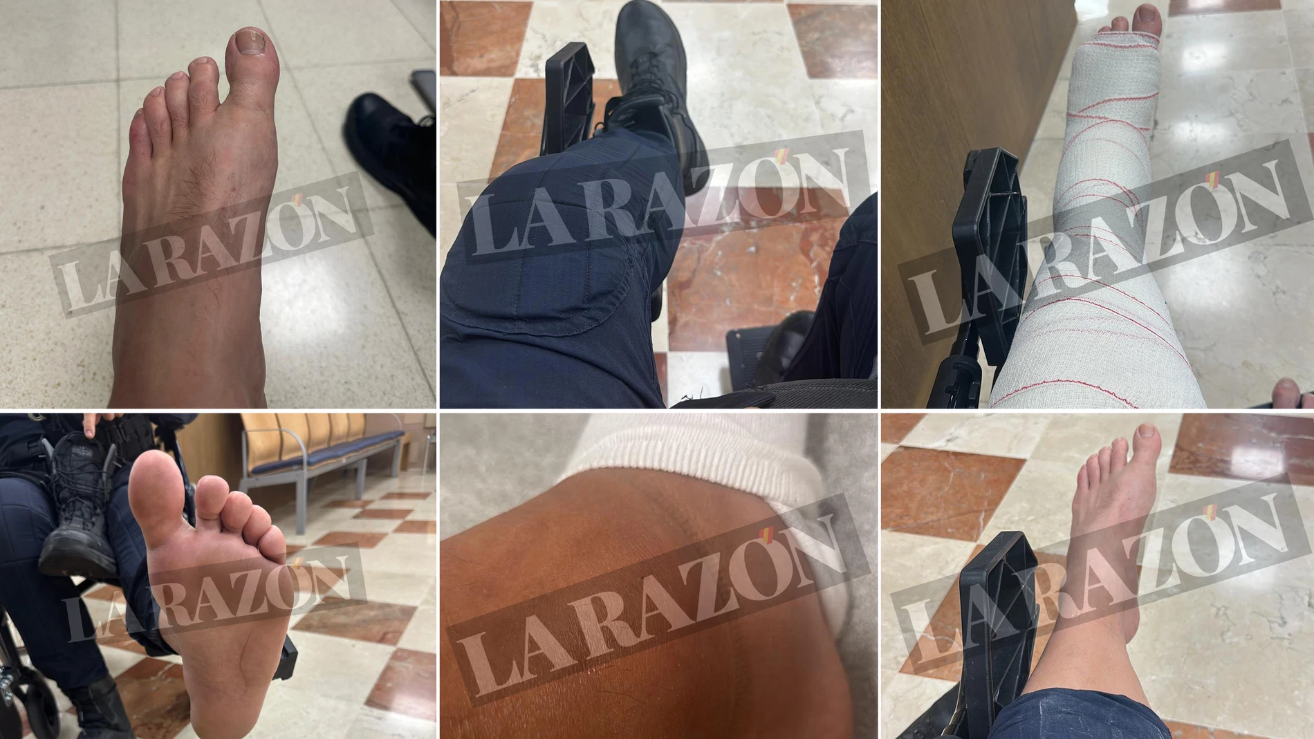 Las heridas de los antidisturbios en los incidentes de la Vuelta en Madrid