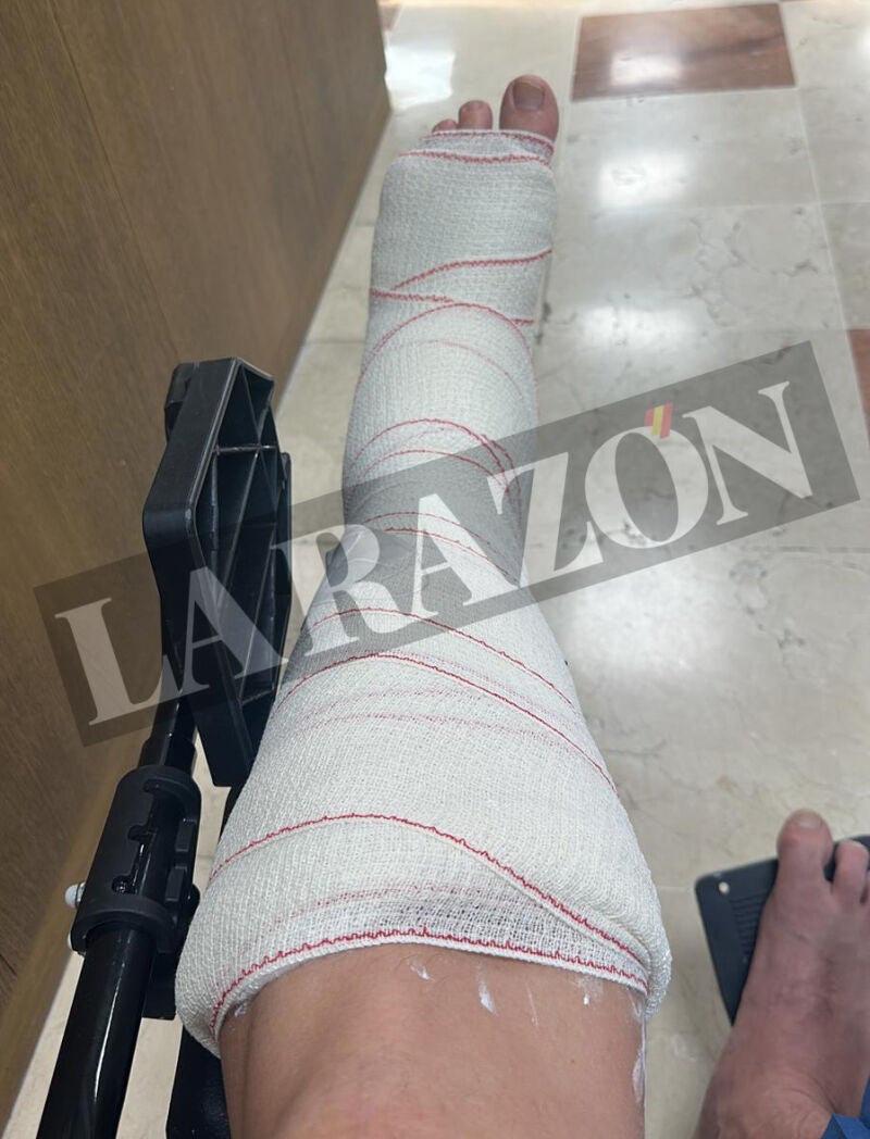 Las heridas de los antidisturbios en los incidentes de la Vuelta en Madrid