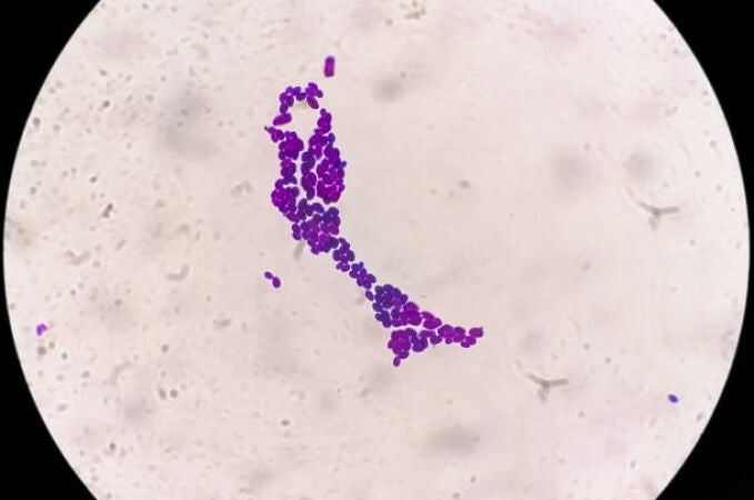 Europa advierte de la expansión del hongo C. auris en los hospitales: ''desde casos aislados hasta convertirse en una epidemia en algunos países''