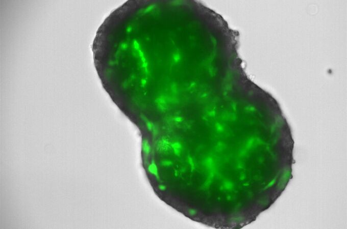 El Centro de Investigación del Cáncer abre nuevas vías terapéuticas para el colangiocarcinoma