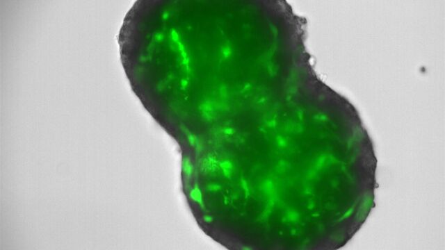El Centro de Investigación del Cáncer abre nuevas vías terapéuticas para el colangiocarcinoma
