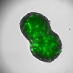 El Centro de Investigación del Cáncer abre nuevas vías terapéuticas para el colangiocarcinoma El Centro de Investigación del Cáncer abre nuevas vías terapéuticas para el colangiocarcinoma