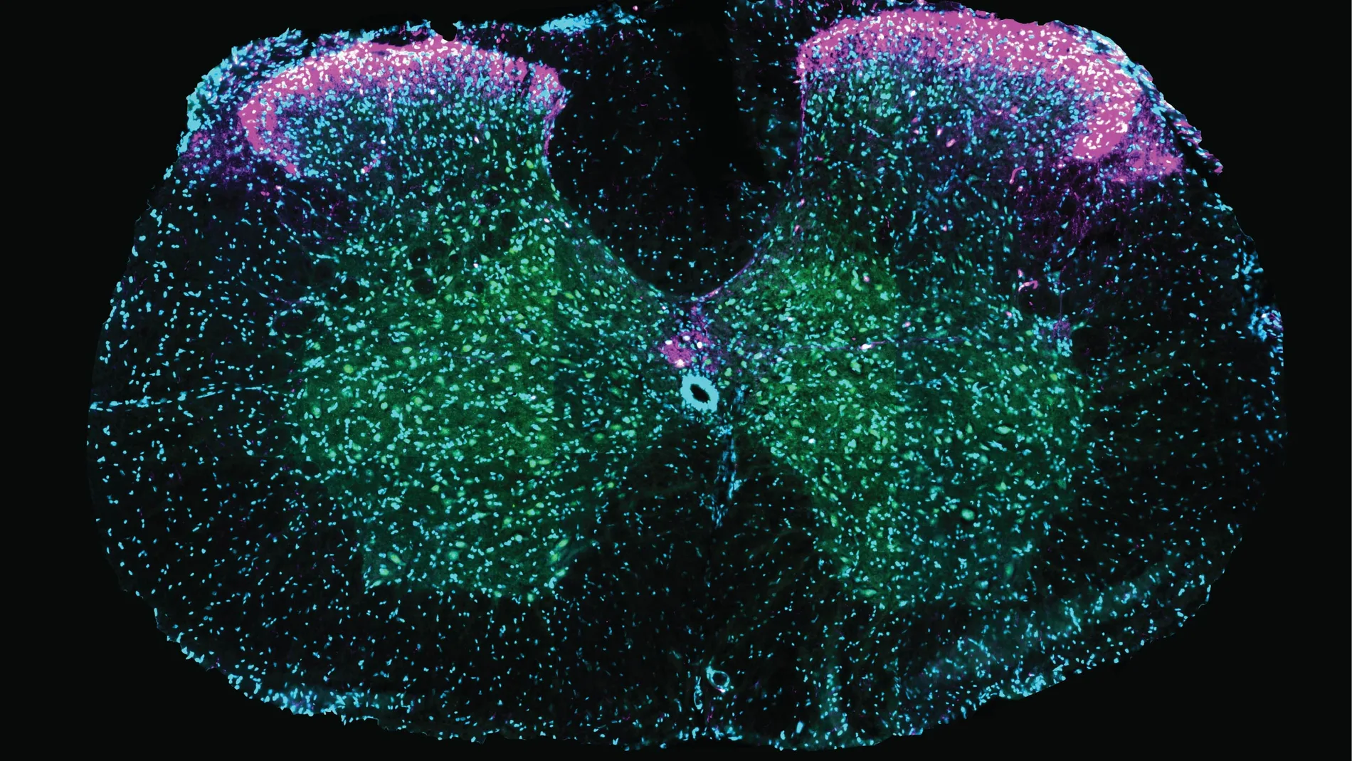 Sección transversal de la médula espinal de un roedor que muestra las neuronas involucradas en la eyaculación. Las células marcadas en rosa (neuronas que expresan galanina) se superponen con las de color verde (una señal de actividad reciente), lo que revela que estas neuronas están activas durante la eyaculación. El color azul marca todas las células nerviosas como guía visual.