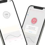 La AEMPS informa de un error en las versiones 1.11.2 y 1.12.0 de la aplicación Dexcom G6 para iOS