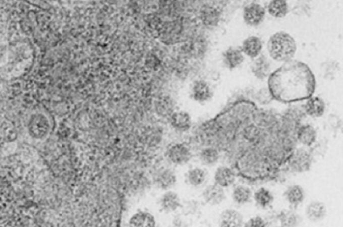 Investigadores españoles desarrollan una vacuna intranasal que elimina el virus del Covid-19 en ratones