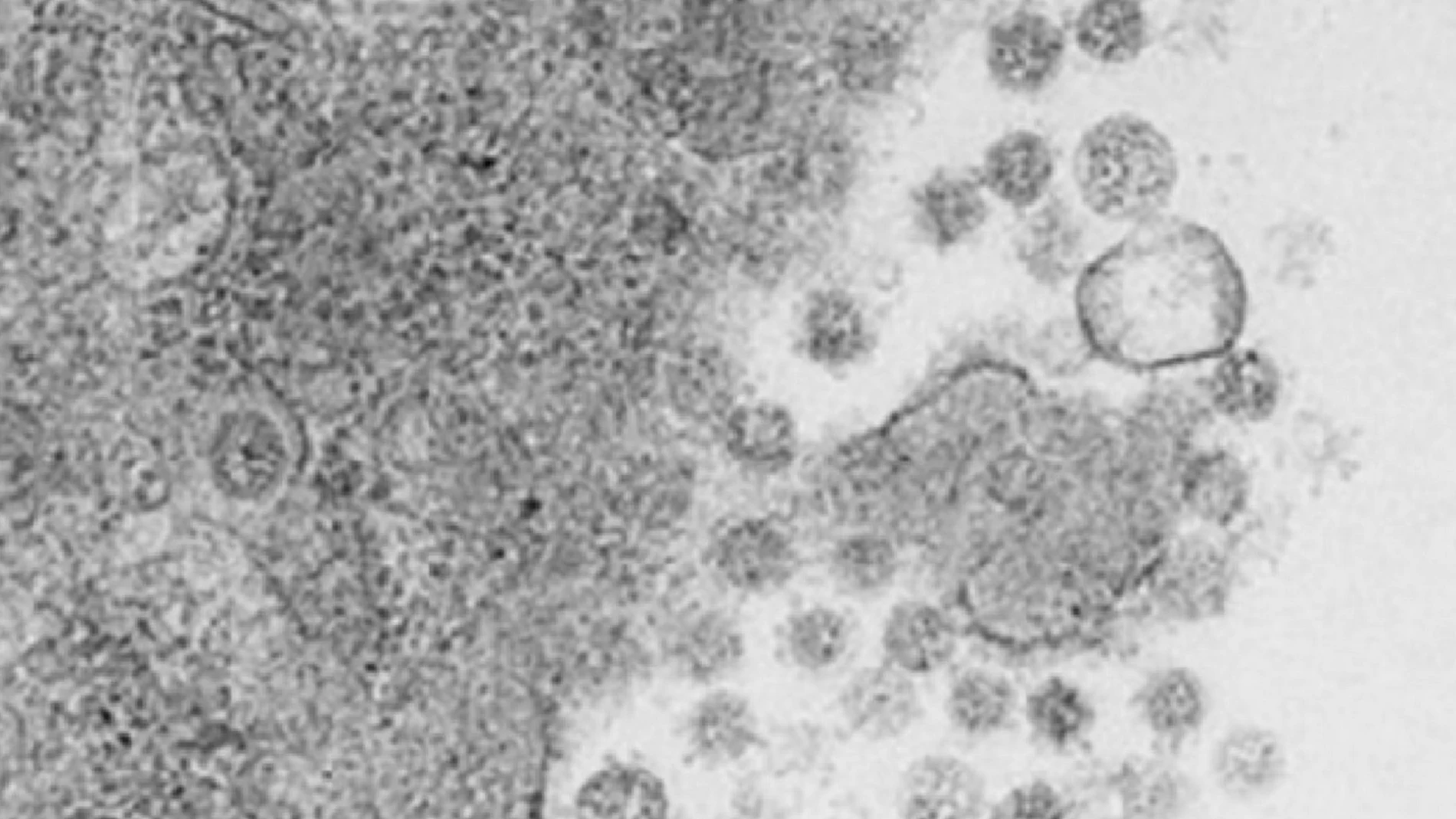 Investigadores españoles desarrollan una vacuna intranasal que elimina el virus del Covid-19 en ratones