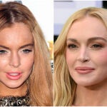 Lindsay Lohan, antes y después
