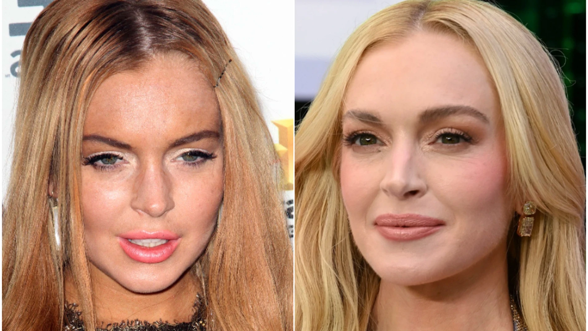 Lindsay Lohan, antes y después