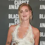 Chiara Ferragni y sus labios con volumen.