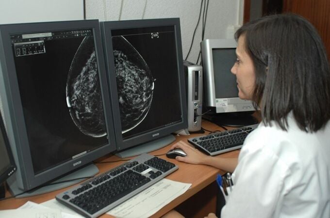Cribado de cáncer de mama del SAS