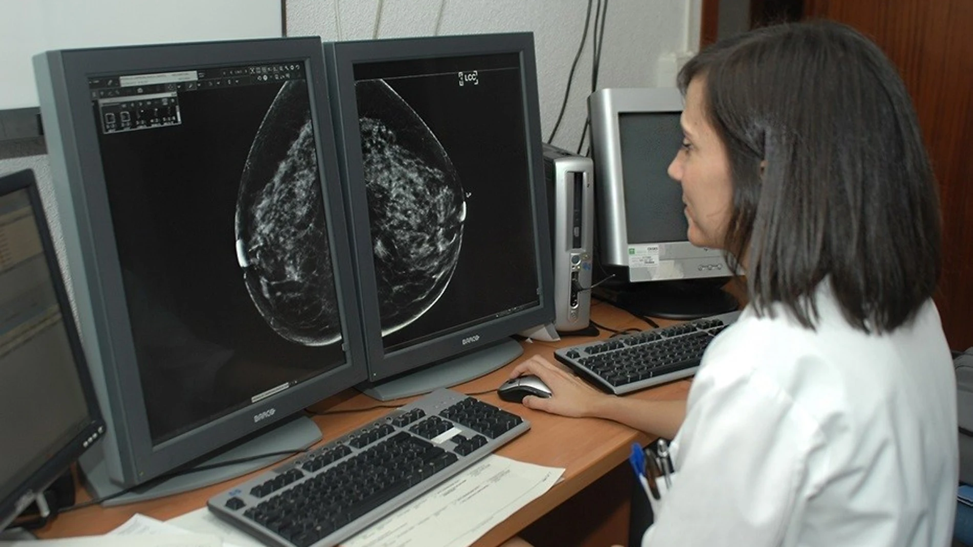 Cribado de cáncer de mama del SAS