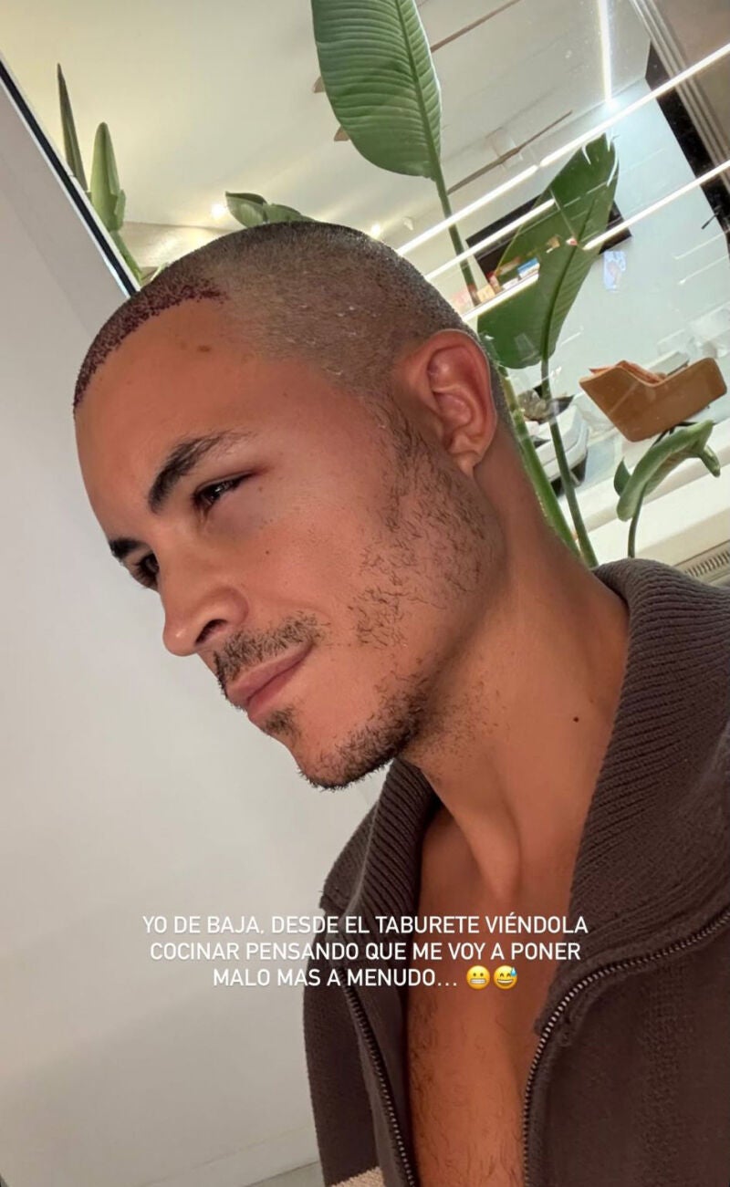 Kiko Jiménez en su recuperación tras el injerto capilar
