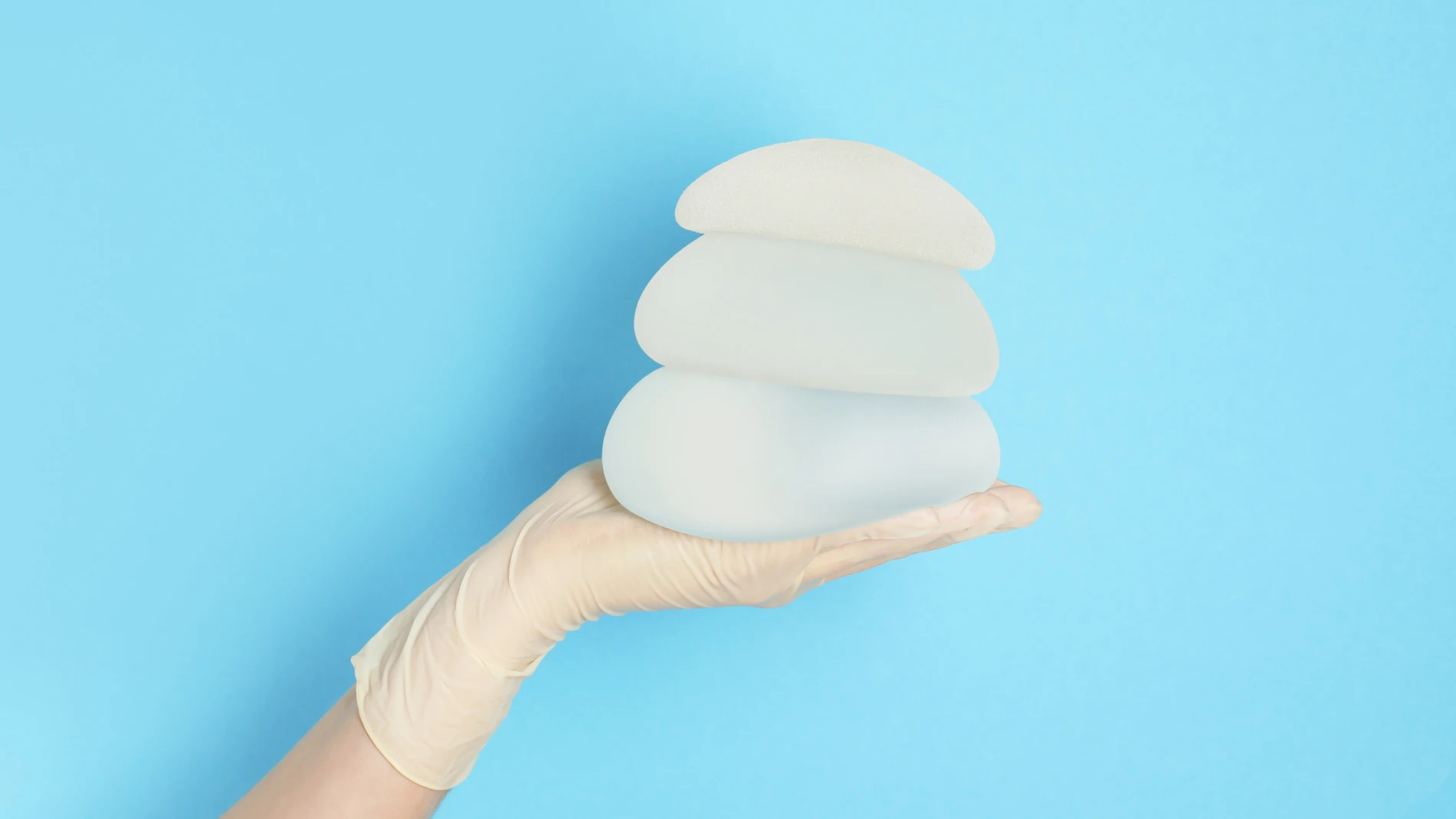 Las mujeres que se están retirando los implantes son las que se los pusieron en el "boom"