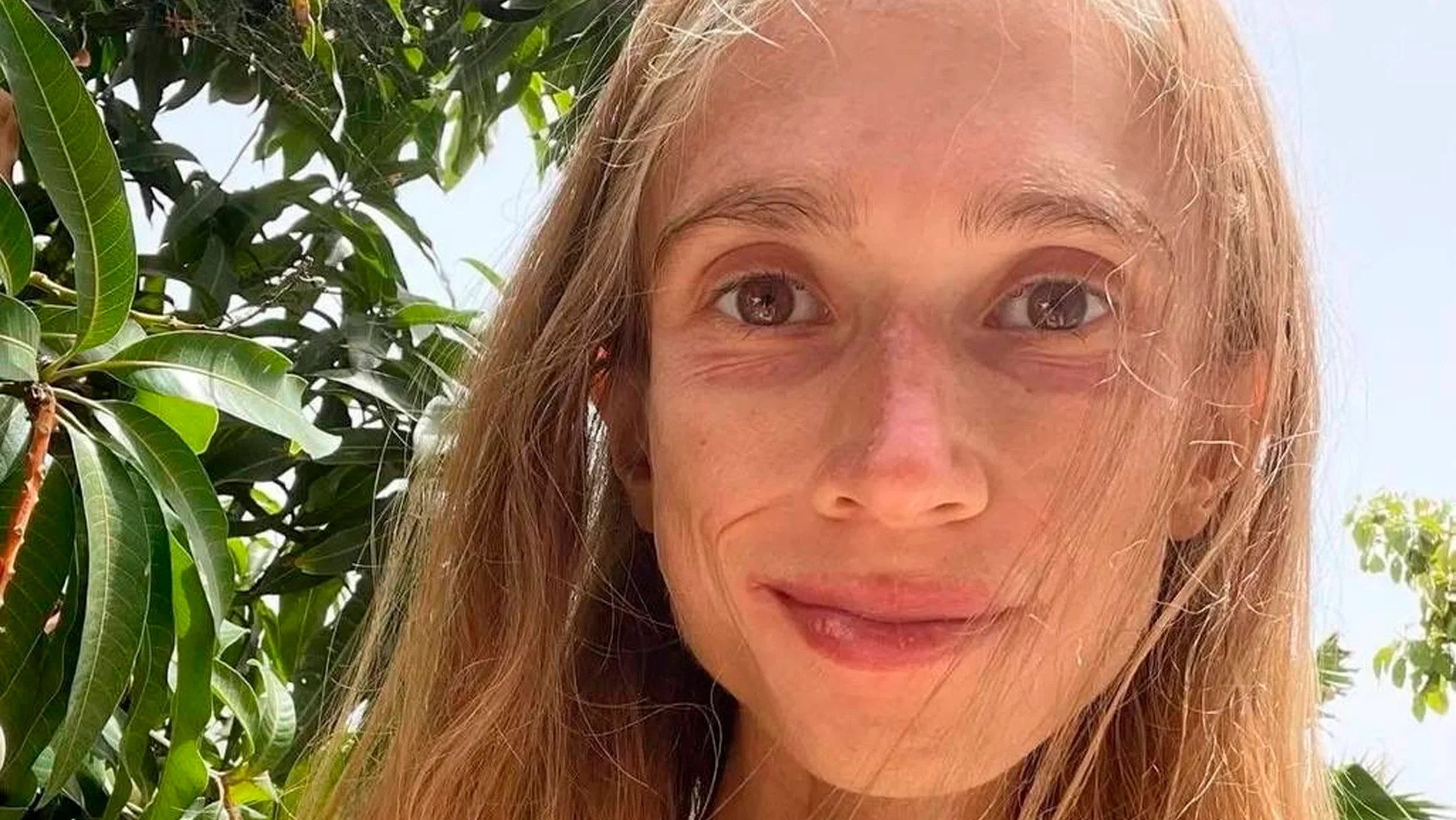 Fallece una influencer vegana que pesaba menos de 30 kilos: su dieta se basaba únicamente en frutas