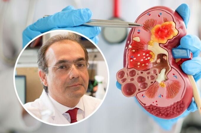 El experto mundial en riñón hereditario participará en el Congreso Nacional de Nefrología en Oviedo