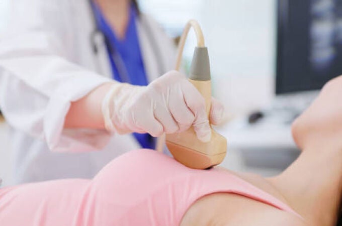 ¿Cuáles son los primeros síntomas que alertan de un posible cáncer de mama?