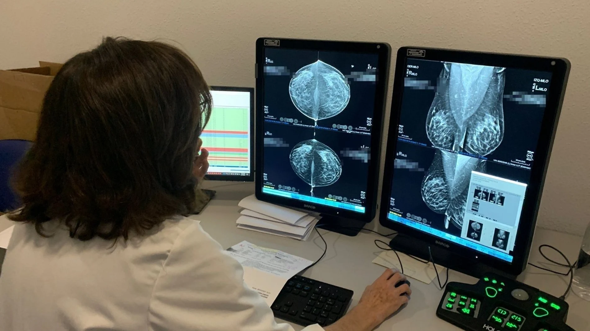 MURCIA.-La Región de Murcia tiene en marcha 80 estudios de investigación relacionados con el cáncer de mama