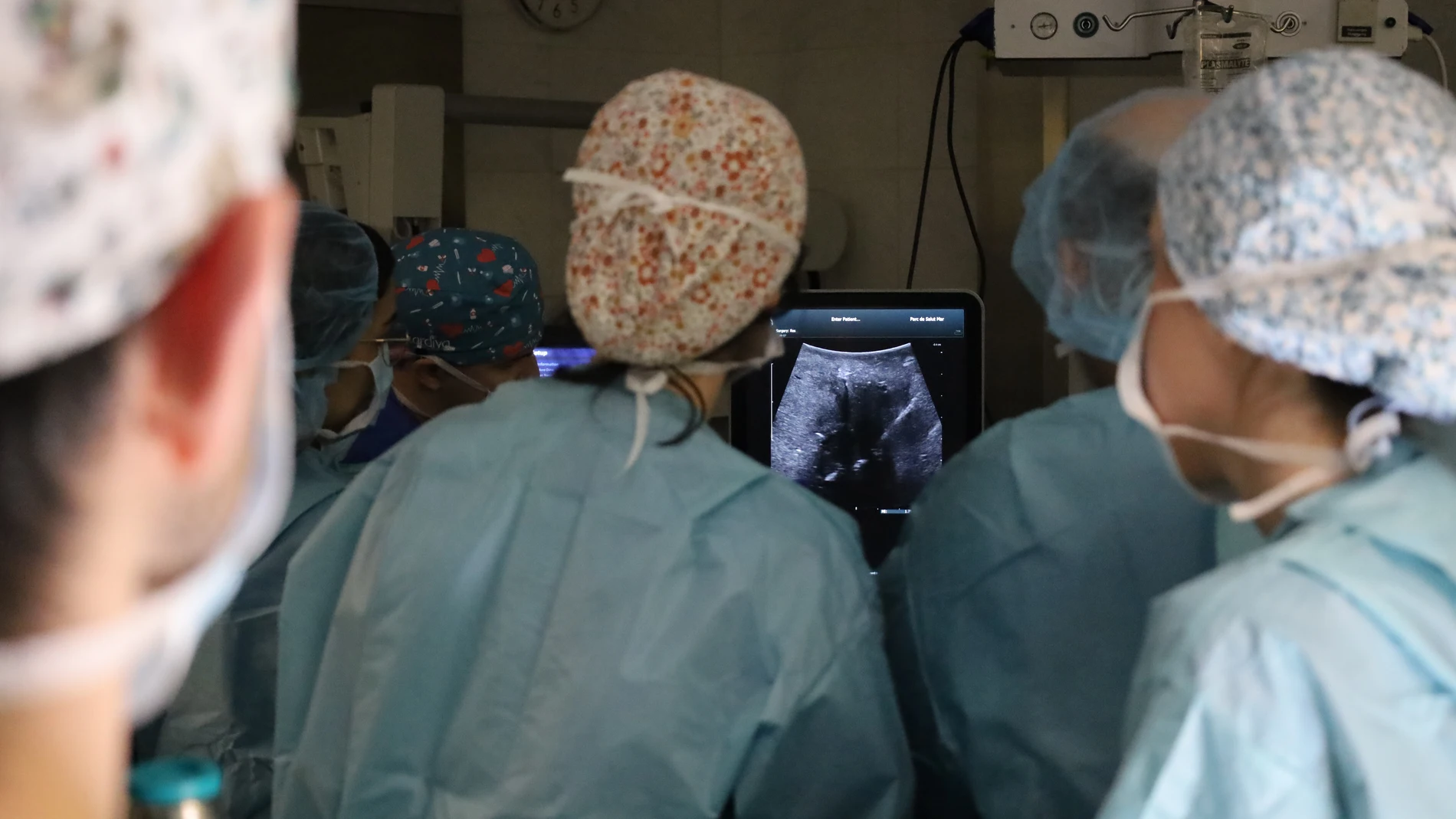 Imagen de la intervención de un tumor con la técnica de electroporación