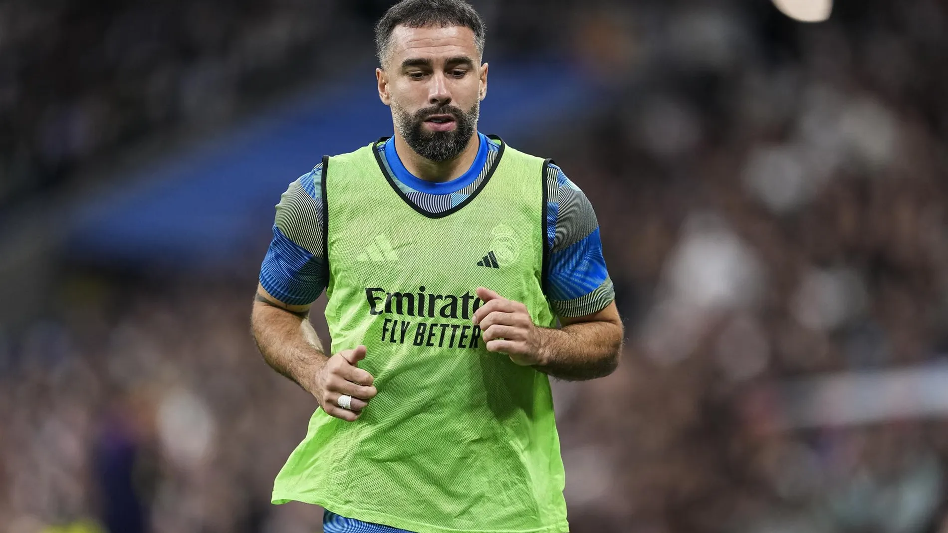 MADRID.-Dani Carvajal deberá someterse a una artroscopia en su rodilla derecha y podría no volver a jugar hasta el 2026