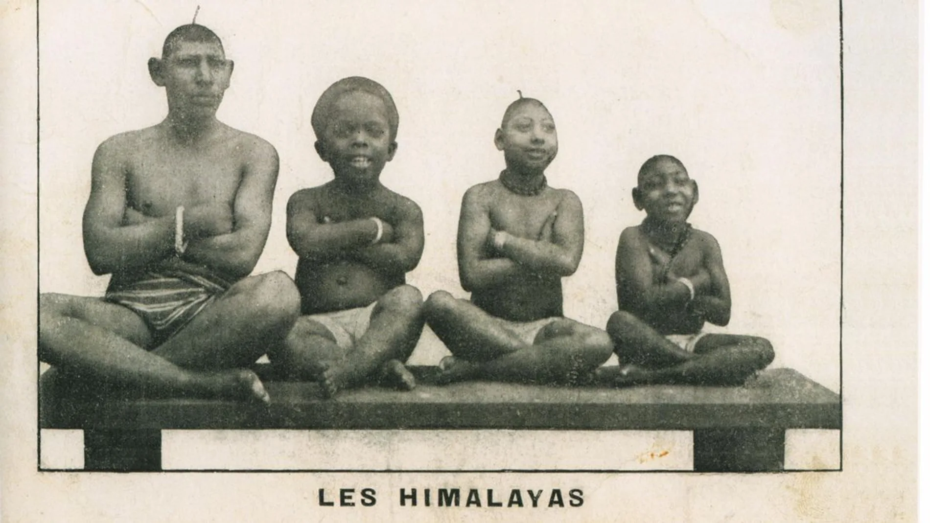 Las antiguas exhibiciones de seres humanos deformes en Barcelona