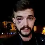 Un periodista, agredido por radicales 'abertzales' que se dirigían al evento cancelado de Vito Quiles en Navarra