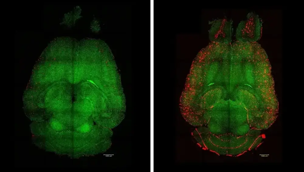 Imágenes de microscopía de fluorescencia con hoja de luz del cerebro de un ratón, 12 horas después de recibir tratamiento con nanopartículas (izquierda) o sin tratamiento (derecha)
