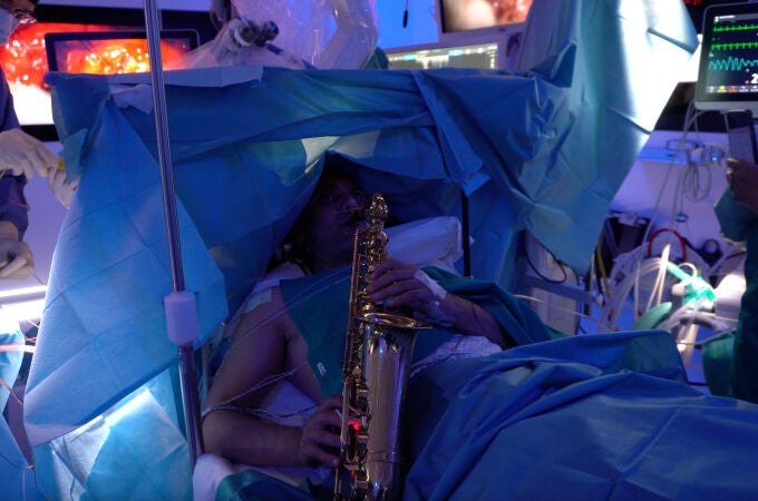 Durante la intervención a un músico Durante la intervención a un músico