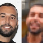 El impactante antes y después de Omar Sánchez, ex de Anabel Pantoja