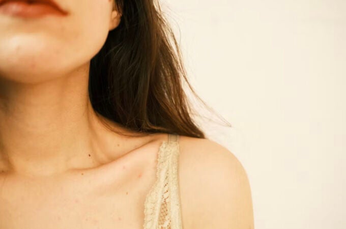 “Ojalá este hallazgo dé esperanza”: vivir con lupus cuando te diagnostican con 7 años “Ojalá este hallazgo dé esperanza”: vivir con lupus cuando te diagnostican con 7 años