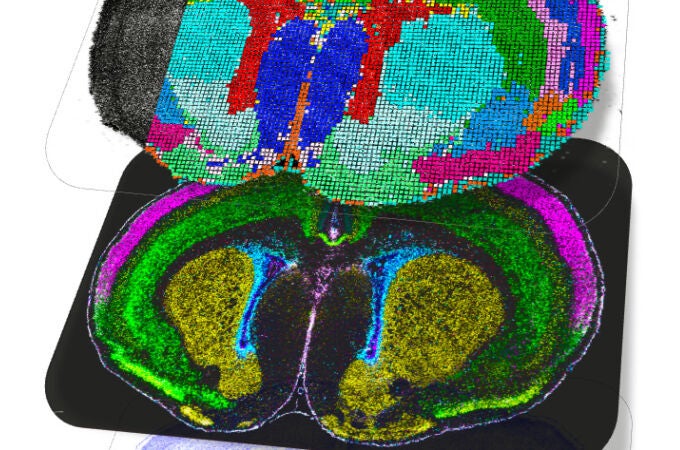 Diferentes capas del cerebro de un ratón justo después de nacer Diferentes capas del cerebro de un ratón justo después de nacer