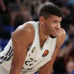 Tavares, en el Palau con un rasguño en la cara que sufrió en el Clásico