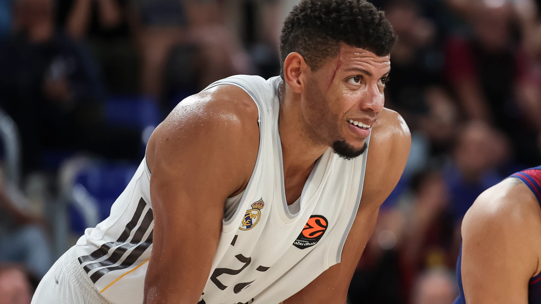 Tavares, en el Palau con un rasguño en la cara que sufrió en el Clásico