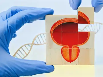 Las nuevas herramientas diagnósticas permiten actuar con mayor precisión Las nuevas herramientas diagnósticas permiten actuar con mayor precisión