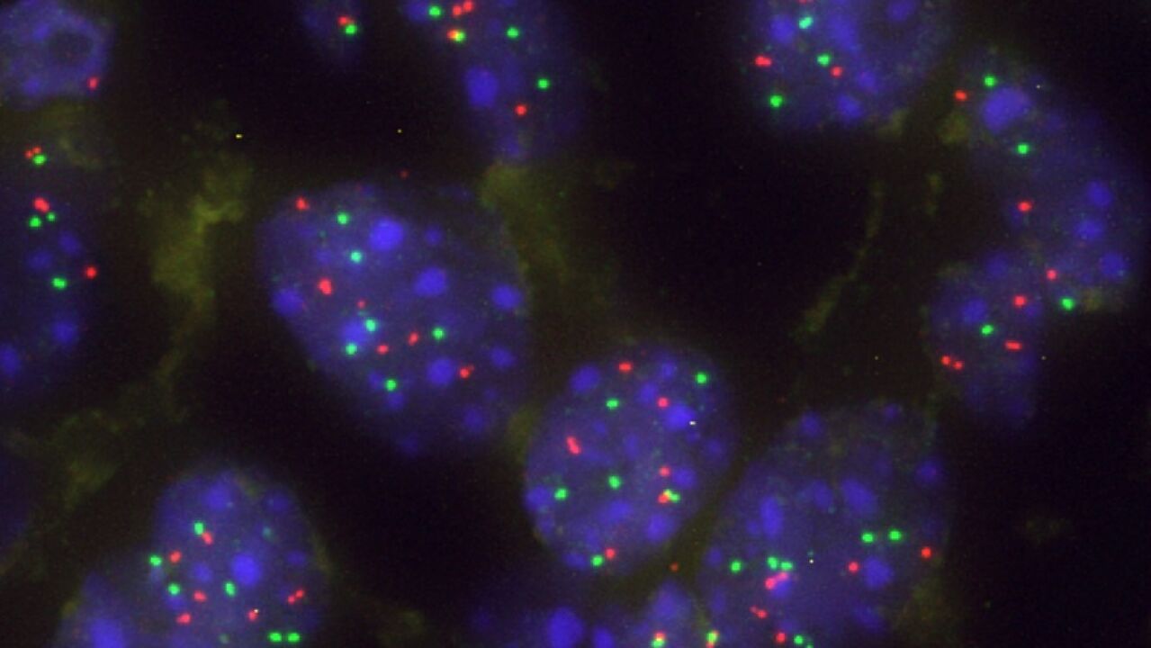Descubren proteína clave en el desarrollo de neoplasmas cancerígenos.