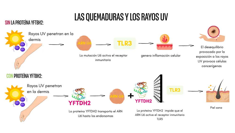 Las quemaduras y los rayos UV