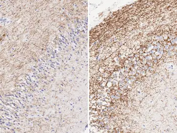 Un estudio mejora el tratamiento de larga duración en memoria e inflamación en síndrome de Down Un estudio mejora el tratamiento de larga duración en memoria e inflamación en síndrome de Down