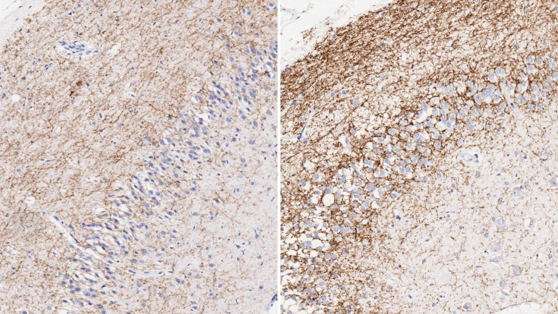 Un estudio mejora el tratamiento de larga duración en memoria e inflamación en síndrome de Down
