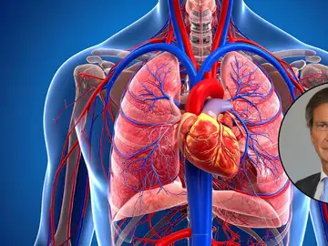 Esta es la prueba que deberías hacerte antes de os 40 para disminuir el riesgo de infarto, según un neurólogo Esta es la prueba que deberías hacerte antes de os 40 para disminuir el riesgo de infarto, según un neurólogo